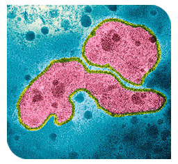 Influenza virus type A.
